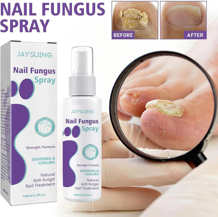 Fungal Nail Treatment