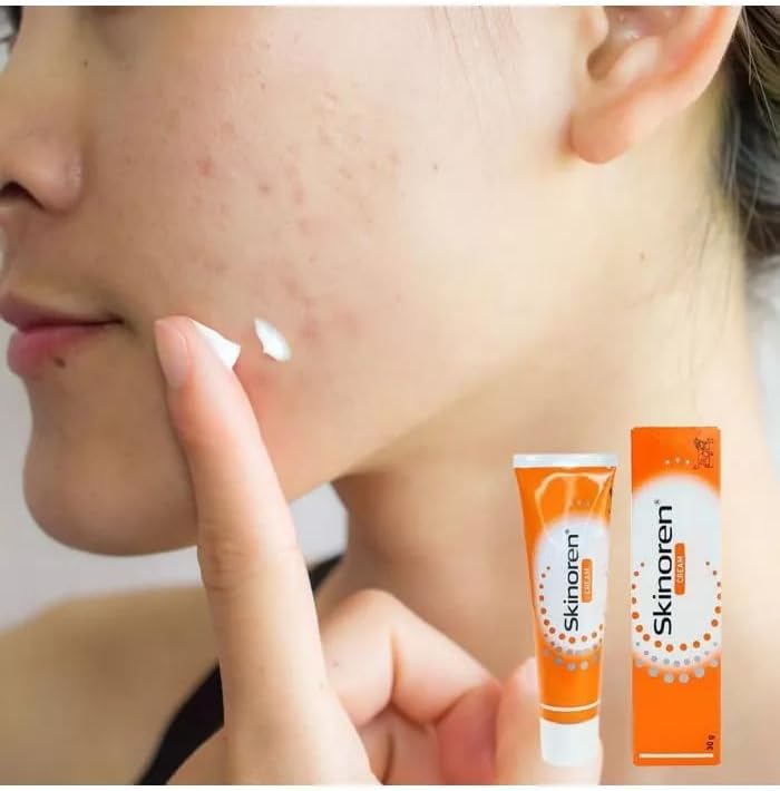 Skinoren Whitening Cream for All Skin Types سكينورين كريم تبييض لجميع أنواع البشرة 30 جرام