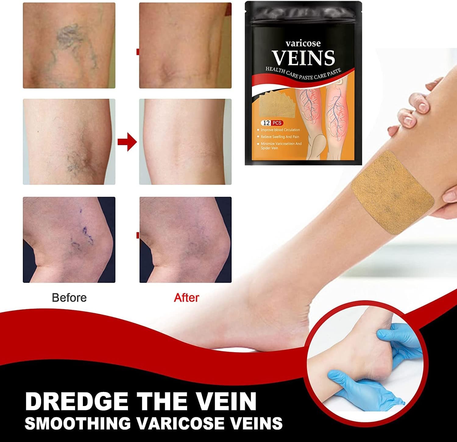 Veins Treatment Patch 24PCS