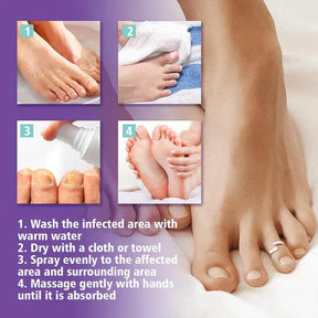 Fungal Nail Treatment