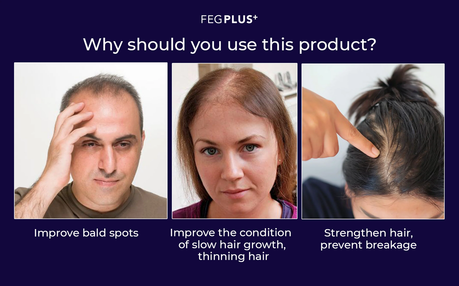 FEG Plus Hair Growth Spray from the US